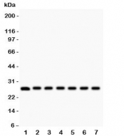 Western blot testing of Galectin 3 antibody and mouse samples 1:  kidney;  2: liver;  3: spleen;  4: ovary;  5: HEPA;  6: ANA-1;  7: NIH3T3 lysate.  Predicted/observed molecular weight ~26kDa