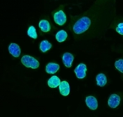 Immunofluorescent staining of FFPE human A431 cells with Lamin A antibody (green) and DAPI nuclear stain (blue). HIER: steam section in pH6 citrate buffer for 20 min.