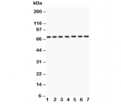 Western blot testing of Lamin A antibody and Lane 1:  human placenta;  2: SKOV;  3: SW620;  4: COLO320;  5: HeLa;  6: 293T;  7: A549 lysate. Predicted molecular weight: ~74 kDa.
