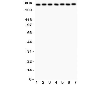 Western blot testing of LRRK2 antibody and Lane 1: rat brain; 2: mouse brain; 3: (r) liver; 4: human U87; 5: (m) Neuro-2a; 6: (h) A549; 7: (h) SMMC-7721 lysate. Expected/observed size ~280KD