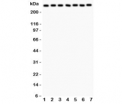 Western blot testing of LRRK2 antibody and Lane 1:  rat brain;  2: mouse brain;  3: (r) liver;  4: human U87;  5: (m) Neuro-2a;  6: (h) A549;  7: (h) SMMC-7721 lysate.  Expected/observed size ~280KD