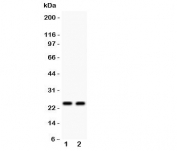 Western blot testing of Mad2L1 antibody and Lane 1:  293T;  2: COLO320 lysate.  Expected molecular weight: ~24 kDa.