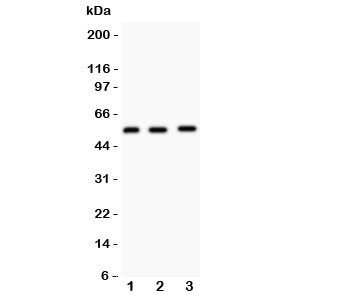 Western blot testing of MMP14 antibody and Lane 1: human placenta; 2: HeLa; 3: U87 lysate. Expected/observed size ~57KD