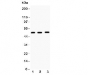 Western blot testing of MMP14 antibody and Lane 1:  human placenta;  2: HeLa;  3: U87 lysate.  Predicted molecular weight: ~66/54kDa.