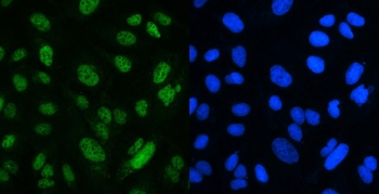 Immunofluorescent staining of FFPE human U-2 OS cells with MSH2 antibody (green) and DAPI nuclear stain (blue). HIER: boil tissue sections in pH6, 10mM citrate buffer, for 20 min and allow to cool before testing.