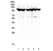 Western blot testing of human 1) HEK293, 2) HEK293 (different lot), 3) HeLa, 4) COLO-320, 5) T-47D and 6) A549 cell lysate with MSH2 antibody. Expected molecular weight: ~105 kDa.