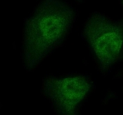 Immunofluorescent staining of FFPE human HeLa cells with NEDD9 antibody. HIER: steam section in pH6 citrate buffer for 20 min.