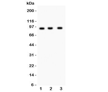 Western blot testing of NEDD9 antibody and Lane 1: Jurkat; 2: CEM; 3: Raji lysate. Predicted/observed size ~93KD