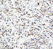 Western blot testing of NEDD9 antibody and Lane 1:  Jurkat;  2: CEM;  3: Raji lysate.  Predicted/observed molecular weight: ~93kDa.