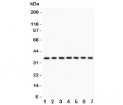 Western blot testing of IkBa antibody and Lane 1:  rat brain;  2: mouse brain;  3: (r) kidney;  4: (m) kidney;  5: human 293T;  6: (h) Jurkat;  7: (h) Raji lysate.  Expected/observed size ~36KD