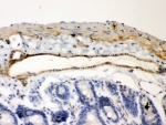 IHC staining of FFPE mouse intestinal tissue with IkB beta antibody, HRP-secondary and DAB substrate. HIER: boil tissue sections in pH8 EDTA for 20 min and allow to cool before testing.