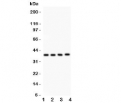 Western blot testing of IkB beta antibody and Lane 1:  mouse kidney;  2: rat RH35;  3: (r) NRK;  4: human HeLa lysate.  Expected/observed size ~38KD