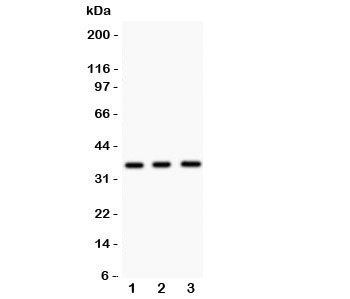 Western blot testing of Nkx2-5 antibody and Lane 1: mouse spleen; 2: mouse heart; 3: human HeLa lysate. Predicted/observed size ~35KD
