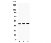 Western blot testing of NKX2.5 antibody and Lane 1:  mouse spleen;  2: mouse heart;  3: human HeLa lysate.  Predicted molecular weight ~35 kDa, routinely observed at 35~45kDa.