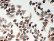 ICC testing of human SMMC-7721 cells with Nod1 antibody. HIER: steam section in pH6 citrate buffer for 20 min and allow to cool prior to testing.