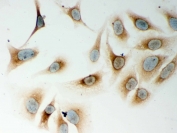 ICC testing of human HeLa cells with Nod1 antibody. HIER: steam section in pH6 citrate buffer for 20 min and allow to cool prior to testing.