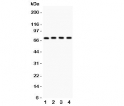 Western blot testing of Neuregulin-1 antibody and Lane 1:  MCF-7;  2: SKOV;  3: 22RV1;  4: COLO320 lysate.  Predicted/observed size ~70KD