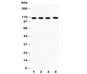 Western blot testing of Neuropilin 1 antibody and Lane 1:  (h) U87;  2: (h) A549;  3: human placenta;  4: rat heart lysate.  Predicted size: 102~130KD