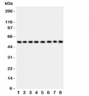 Western blot testing of P2X2 antibody and Lane 1:  rat brain;  2: mouse brain;  3: human placenta;  4: (h) HeLa;  5: (h) SHG-44;  6: (m) Neuro-2a;  7: (h) 22RV1;  8: (h) U87 lysate.  Expected size 41~55KD