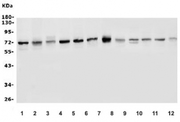 Western blot testing of 1) human HeLa, 2) human MCF7, 3) human A375, 4) human T-47D, 5) human A549, 6) monkey COS-7, 7) rat NRK, 8) rat RH-35, 9) mouse kidney, 10) mouse liver, 11) mouse RAW264.7 and 12) mouse HEPA1-6 cell lysate with P2X4 antibody. Expected molecular weight: 43-70 kDa depending on glycosylation