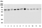 Western blot testing of 1) human HeLa, 2) human MCF7, 3) human A375, 4) human T-47D, 5) human A549, 6) monkey COS-7, 7) rat NRK, 8) rat RH-35, 9) mouse kidney, 10) mouse liver, 11) mouse RAW264.7 and 12) mouse HEPA1-6 cell lysate with P2X4 antibody. Expected molecular weight: 43-70 kDa depending on glycosylation level.