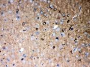 IHC-P: P2X5 antibody testing of rat brain tissue