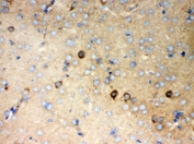 IHC-P: P2X5 antibody testing of mouse brain tissue