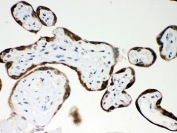 IHC-P: PAPP A antibody testing of human placenta tissue