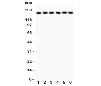 Western blot testing of PAPP-A antibody and human samples 1: placenta; 2: HT1080; 3: SKOV; 4: 22RV1; 5: SW620; 6: MM231 lysate. Predicted/observed size ~180KD~