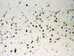 IHC-P: Parkin antibody testing of rat brain tissue. HIER: steamed with pH6 citrate buffer.