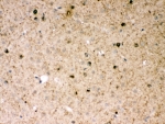 IHC-P: Parkin antibody testing of mouse brain tissue. HIER: steamed with pH6 citrate buffer.