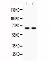 Western blot testing of Parkin antibody and Lane 1:  U87;  2: mouse brain lysate. Expected molecular weight: 50-60 kDa with multiple smaller isoforms.