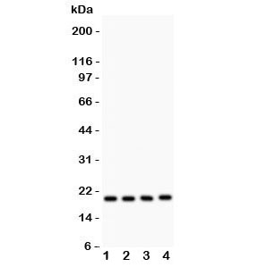 Western blot testing of DJ-1 antibody and human samples 1: PANC; 2: U20S; 3: SMMC-7721; 4: HeLa lysate. Predicted/observed size ~20KD