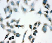 ICC testing of human A549 cells with DJ-1 antibody.