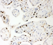 IHC-P: PARP antibody testing of human placenta tissue. HIER: steamed with pH6 citrate buffer.