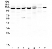 Western blot testing of human 1) HeLa, 2) HepG2, 3) COLO-320, 4) Jurkat, 5) rat PC-12, 6) mouse NIH 3T3 and 7) mouse HEPA 1-6 lysate with PARP antibody at 0.5ug/ml. Predicted molecular weight: ~116 kDa (full length), ~89 kDa (C-terminal catalytic domain).
