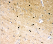IHC-P: PARP antibody testing of rat brain tissue. HIER: steamed with pH6 citrate buffer.