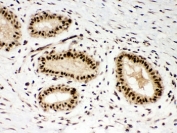 IHC-P: PBK antibody testing of human breast tissue