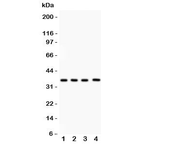 Western blot testing of PBK antibody and Lane 1: rat testis; 2: mouse testis; 3: human placenta; 4: (h) Jurkat lysate. Predicted/observed size ~36KD