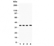 Western blot testing of PBK antibody and Lane 1:  rat testis;  2: mouse testis;  3: human placenta;  4: (h) Jurkat lysate.  Predicted molecular weight: ~36 kDa.