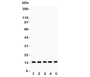 Western blot testing of Profilin-1 antibody and Lane 1: rat testis; 2: mouse testis; 3: human placenta; 4: (h) PANC; 5: (h) SW620 lysate. Expceted size ~15KD