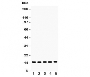Western blot testing of Profilin-1 antibody and Lane 1:  rat testis;  2: mouse testis;  3: human placenta;  4: (h) PANC;  5: (h) SW620 lysate.  Expected molecular weight ~15 kDa.