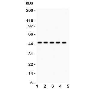 Western blot testing of PIM-1 antibody and human samples 1: U20S; 2: A549; 3: COLO320; 4: SW620; 5: Jurkat. Predicted/observed size ~45KD