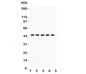 Western blot testing of PIM-1 antibody and human samples 1:  U20S;  2: A549;  3: COLO320;  4: SW620;  5: Jurkat.  Western blot testing of human Jurkat cell lysate with PIM1 antibody. Predicted molecular weight ~44 kDa (PIM-1L) and ~34 kDa (PIM-1S).