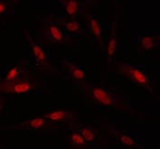 Immunofluorescent staining of FFPE human U-87 MG cells with PIN1 antibody (red). HIER: steam section in pH6 citrate buffer for 20 min.