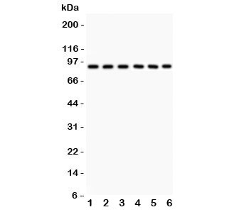 Western blot testing of Oct-1 antibody and Lane 1: rat liver; and human samples 2: placenta; 3: Jurkat; 4: HeLa; 5: A549; 6: SMMC-7721. Predicted/observed size ~89KD~