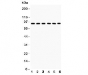 Western blot testing of Oct-1 antibody and Lane 1:  rat liver;  and human samples 2: placenta;  3: Jurkat;  4: HeLa;  5: A549;  6: SMMC-7721.  Predicted molecular weight ~89 kDa.