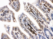 IHC staining of FFPE mouse intestinal tissue with PKC alpha antibody at 1ug/ml. HIER: boil tissue sections in pH6, 10mM citrate buffer, for 10-20 min and allow to cool before testing.