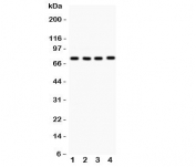 Western blot testing of PKC alpha antibody and Lane 1:  rat brain;  2: mouse brain;  3: (m) heart;  4: human 22RV1.  Predicted molecular weight: ~77 kDa.