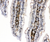IHC staining of FFPE rat intestinal tissue with PKC alpha antibody at 1ug/ml. HIER: boil tissue sections in pH6, 10mM citrate buffer, for 10-20 min and allow to cool before testing.